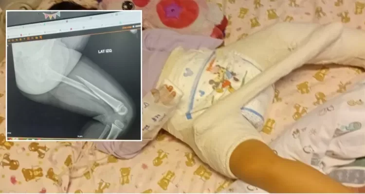 Fundación Integra deberá pagar indemnización tras fractura de fémur de niña en jardín infantil de La Araucanía