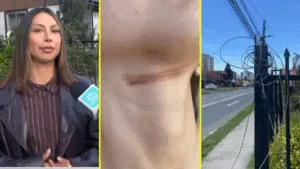 Municipio de Temuco acompaña a ciclista accidentada por cable en desuso y evalúa acciones legales